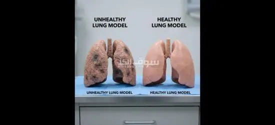 💧 بخاخ تنقية الرئة العشبي (30 مل)تركيبة طبيعية خفيفة تعطيك دعم يومي لجهازك التنفسي بكل راحة! - 4