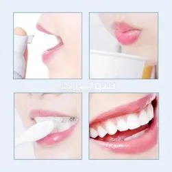 موس تبييض الأسنان - 3
