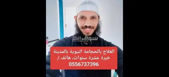 الحجامة النبوية بالمدينة، خبرة عشرة سنوات - 2