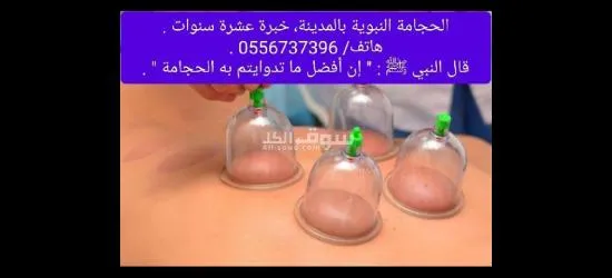 الحجامة النبوية بالمدينة