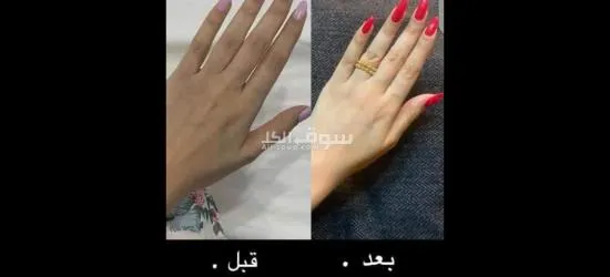 أم سعود للتبيض - 4